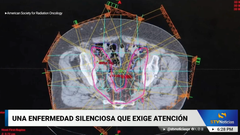 El cáncer de próstata: Una enfermedad silenciosa que acaba con la vida de miles de hombres  